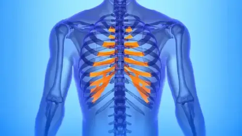 What are the most Effective Treatment Options for Costochondritis?